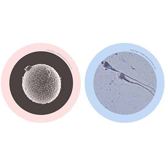 Detalle microscópico de un óvulo (izda) y un espermatozoide (dcha)
