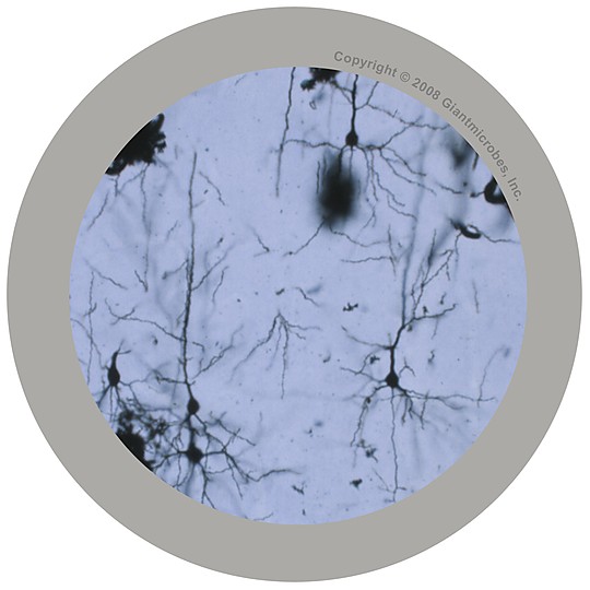 Neurone cell seen under microscope
