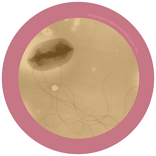 Detalle microscópico de la bacteria E. Coli