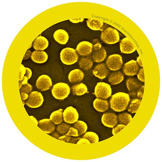 Imagen de un staphylacoccus aureus