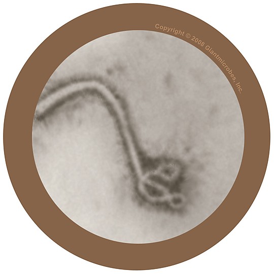 Detalle micróscopico del virus del ébola